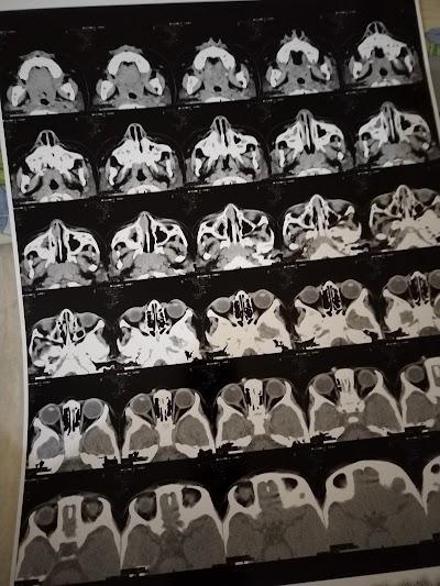 منصوره سكان للاشعه ا.د / مجدى الرخاوى