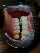 Diş Hekimi Akif Kürtüncü