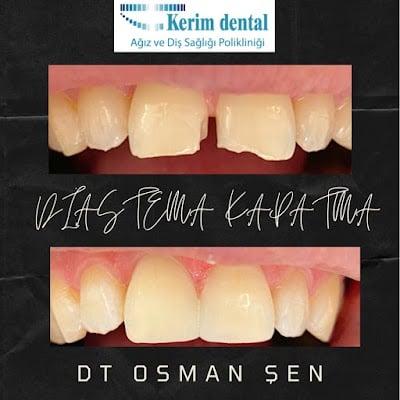 KERİMDENTAL Ağız ve diş sağılığı Polikliniği