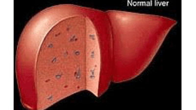 Liver Care Clinic Homeopathy- Amogh clinic specialist/patna/dr s kharari and team