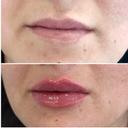 Dr. Turkia Al Ammori - الدكتورة تركية العموري