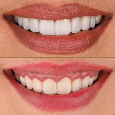 MyoSmile Polyclinic - Dental Clinic in Jumeirah