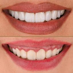 MyoSmile Polyclinic - Dental Clinic in Jumeirah