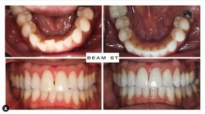 Beam Dental Union Square