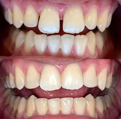 Dr Giorgos Charalambous, DMD