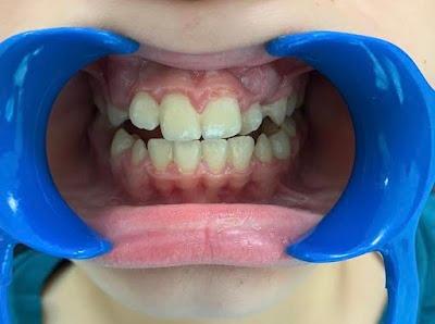 Ortodonti Uzmanı Dr. Rıdvan CEYLAN - İzmit Ortodonti - Gebze Ortodonti - İzmit Diş Teli - Gebze Diş Teli