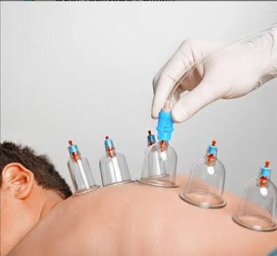 Konya Konterapi hacamat& sülük