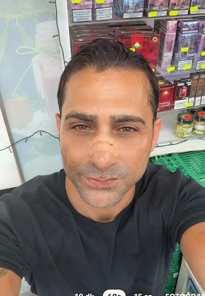 Op. Dr. Özcan Öcük - Estetik & Plastik Cerrahi