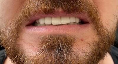 SAKARYA BAYDENTAL AĞIZ VE DİŞ SAĞLIĞI POLİKLİNİĞİ