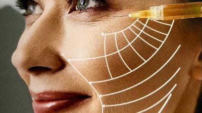 Arztpraxis für Mikroneedling mit Dermapen | Vampirlifting | PRP Therapie | Ästhetische Gesichtsbehandlung