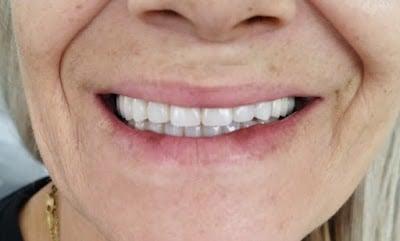 Kaval Ağız ve Diş Sağlığı Polikliniği