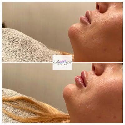 Aesthetics By Eloisé