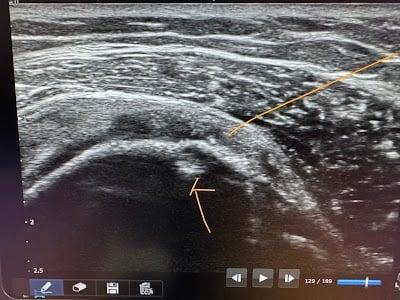 My MSK Injection Clinic Manchester