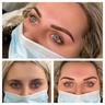 CHRISTINE ALISON PERMANENT MAKE-UP, LASER & SKIN CLINIC LTD