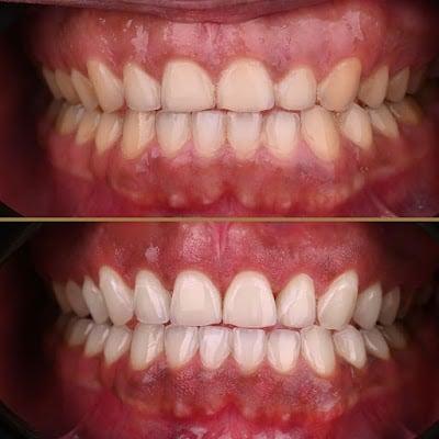 Oral Surgeon Dr. Mayyas Joudi - Dental Implantology and Periodontist