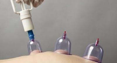 Karşıyaka Bostanlı Kupa Hacamat Terapi ve Masaj