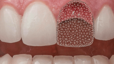 Nevdent Diş Polikliniği