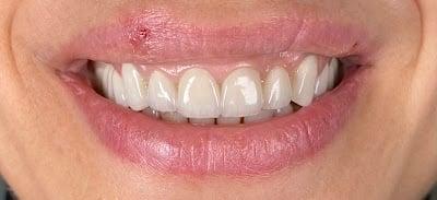 Özer Dent Ağız ve Diş Sağlığı Polikliniği