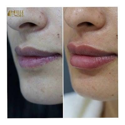 Belle 365 Polyclinic