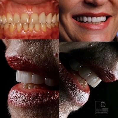 DigitalDent Ağız ve Diş Sağlığı Polikliniği