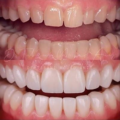 Dr Anis Mouad Tabani