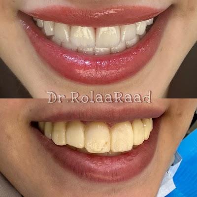 Rolaa Raad Al Aadami Dental Clinic