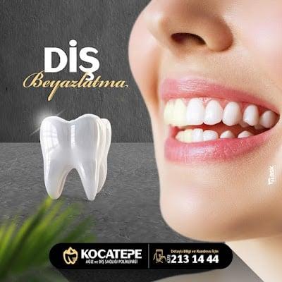 Özel Kocatepe Ağız ve Diş Sağlığı Polikliniği