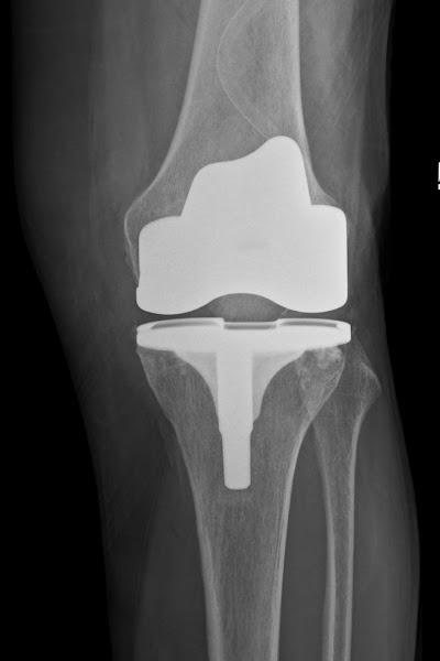 Ortopedi ve Travmatoloji Uzmanı - Op Dr Burak Abay