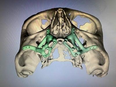 Best Dentist in Turkey İstanbul - Dr. Samet - Dental Implants Turkey - Best Dental Clinic in Turkey