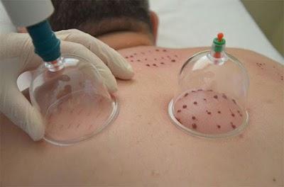 Isparta Hacamat - Dr. Halil Korkmaz