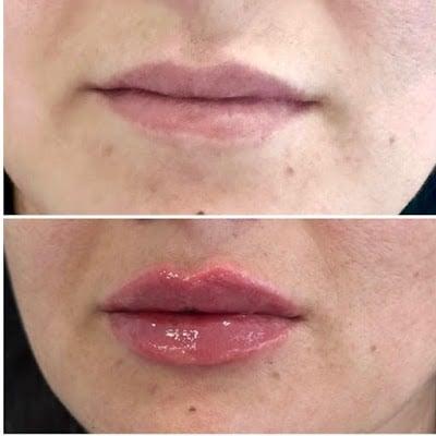 Dr. Turkia Al Ammori - الدكتورة تركية العموري