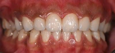 Diş Hekimi Recep Düzsöz | Denizli Özel Ağız ve Diş Sağlığı Kliniği